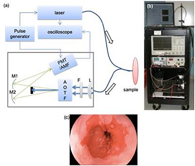 Optical Biopsy of the Upper GI Tract Using Fluorescence Lifetime and Spectra